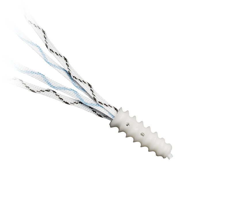 Arthrex - PEEK Corkscrew FT Suture Anchor, 4.75 mm x 14 mm w